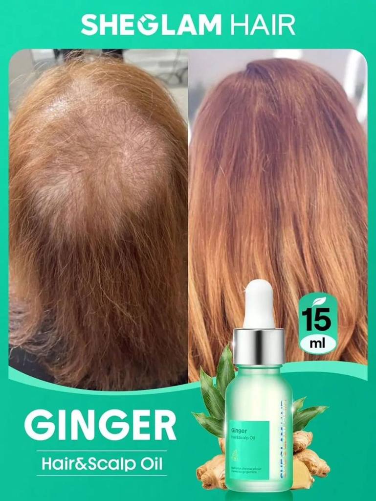 [72403] SHEGLAM Hair Ginger Hair & Sclap Oil -15ml/0.5 Fl OZ